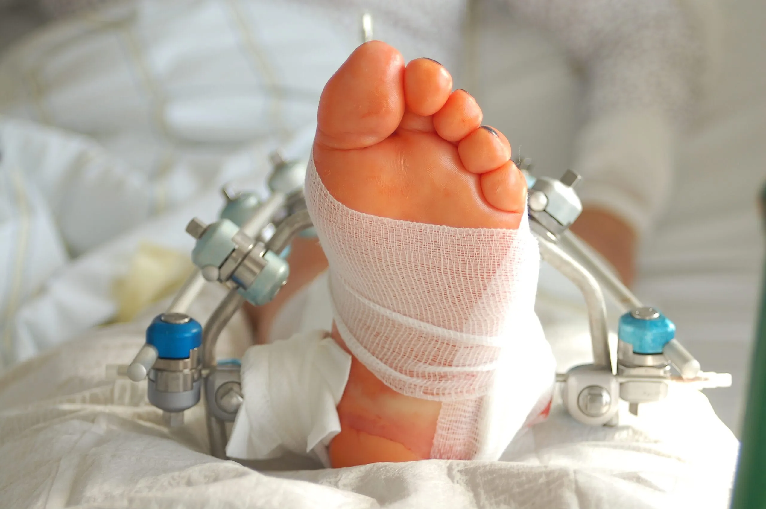 Krankenstand: Jeder Dritte fehlt nie